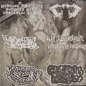 A Kitchen Trashbag Leaking With Pulpified Parts, Carcinomas Of Unknown Primary Origin, Hepatobiliary Tubelike Structures Deficiency, Rapid Cells Amoebiastic Autolyses By Exogenia, Vomit-Colored Enema Droplet, Conscious During A Craniectomy - 6-Way Split download mp3 flac