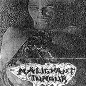 Malignant Tumour - Crush Syndrome Surgical Problems download free