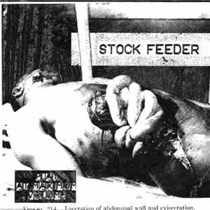 Stock Feeder - Laceration Of Abdominal Wall And Evisceration download free